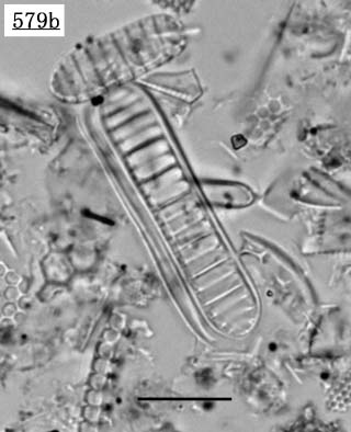 デンティクロプシス属(Denticulopsis sp.)