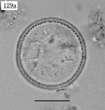 nCAfBXNX(Hyalodiscus sp.)