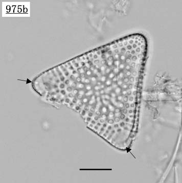 シュードトリセラティウム属(Pseudotriceratium sp.)