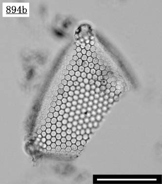 トリセラティウム属（Triceratium favus）