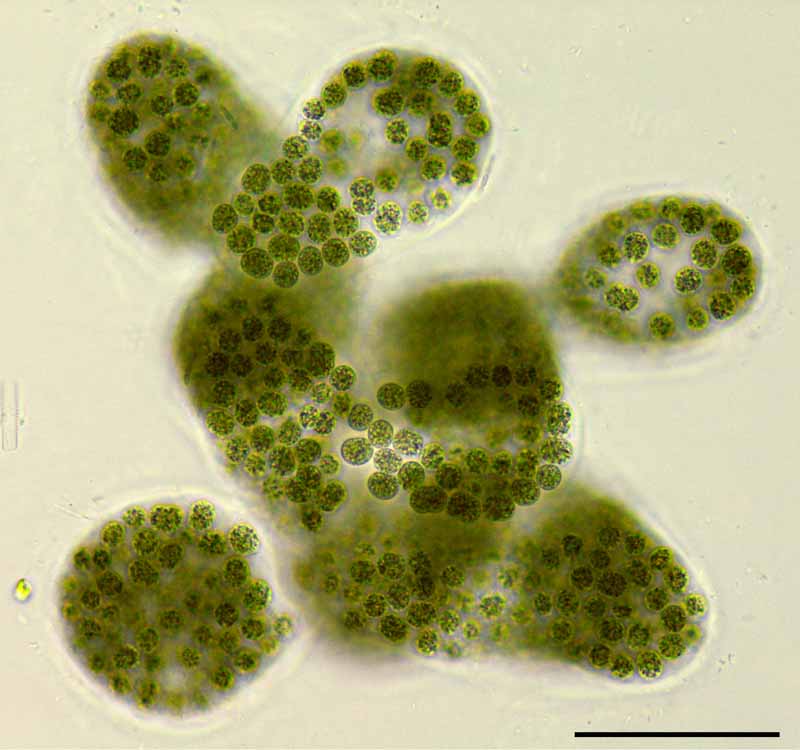 ミクロキスチス （Microcystis）の画像 