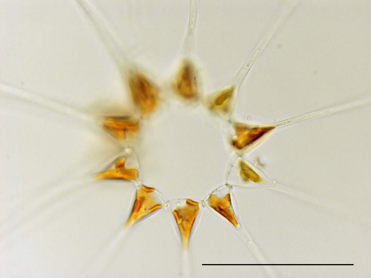 アステリオネロプシス（Asterionellopsis glacialis）の画像