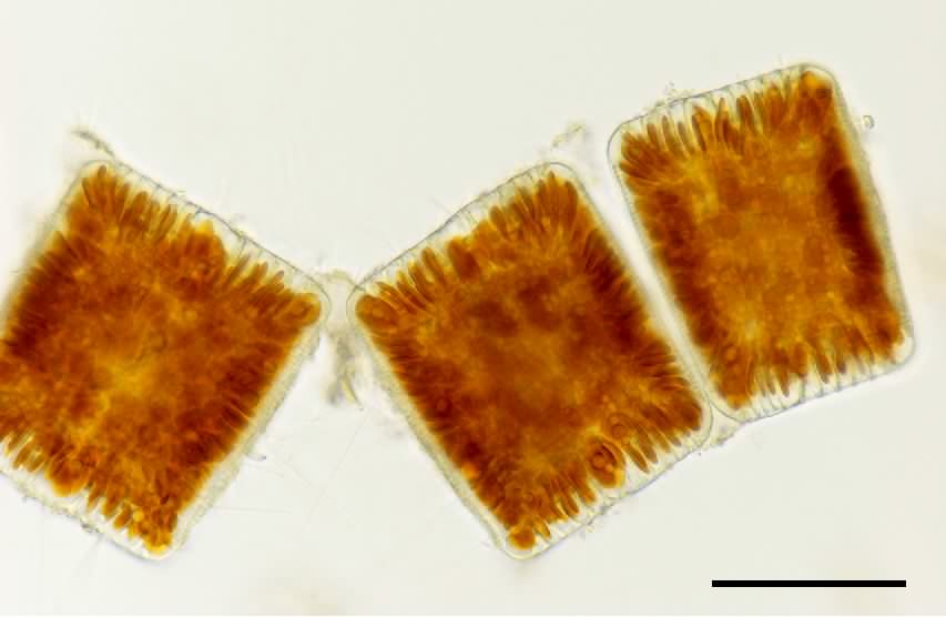 ラブドネマ （Rhabdonema sp.）の画像