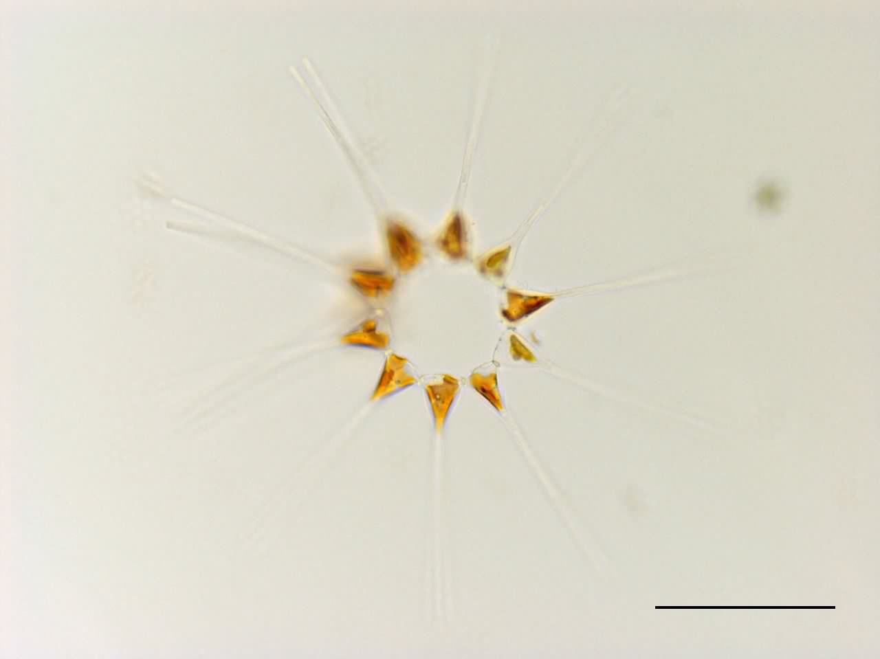 アステリオネロプシス（Asterionellopsis glacialis）の画像