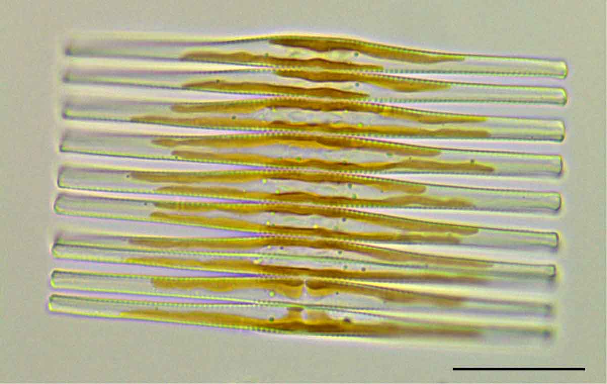 フラギラリア (Fragilaria sp.）の画像