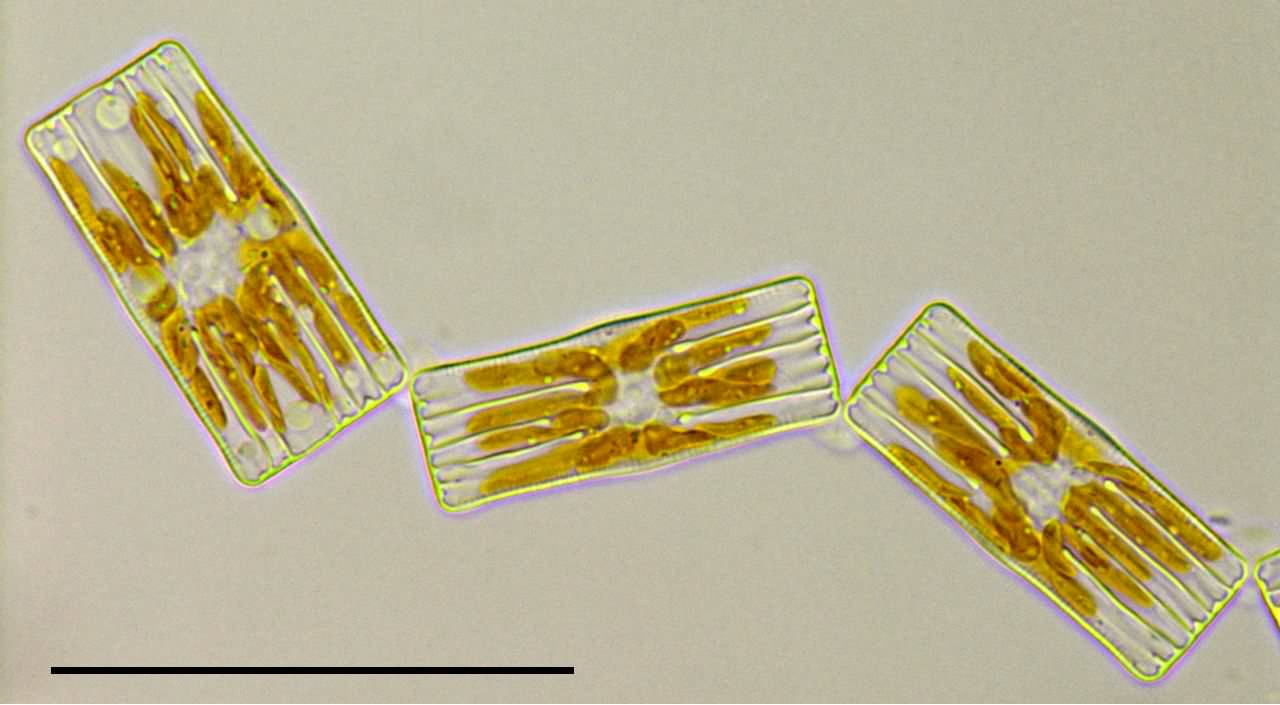 ヌサガタケイソウ （Tabellaria sp.）の画像