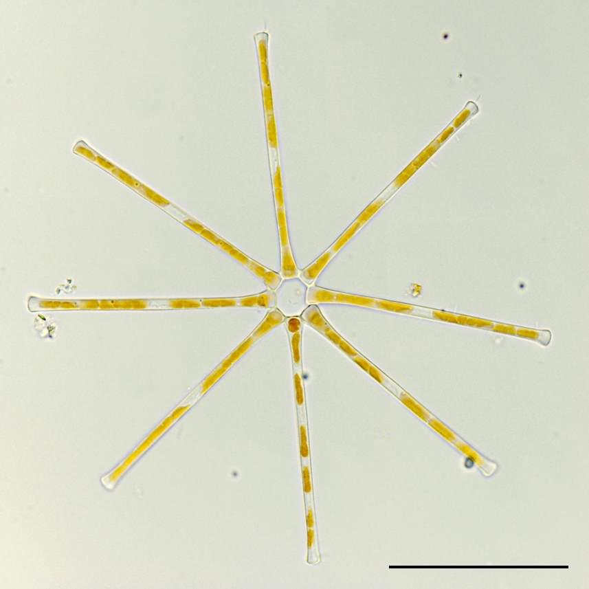 ホシガタケイソウ（Asterionella sp.）の画像