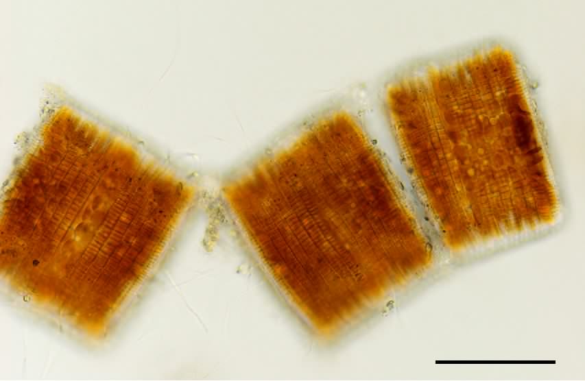 ラブドネマ （Rhabdonema sp.）の画像