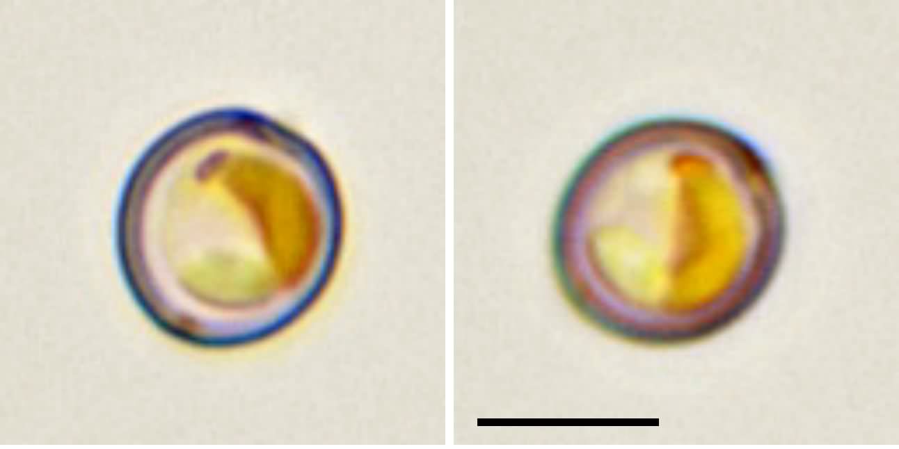 クリソコックス (Chrysococcus sp.)の画像