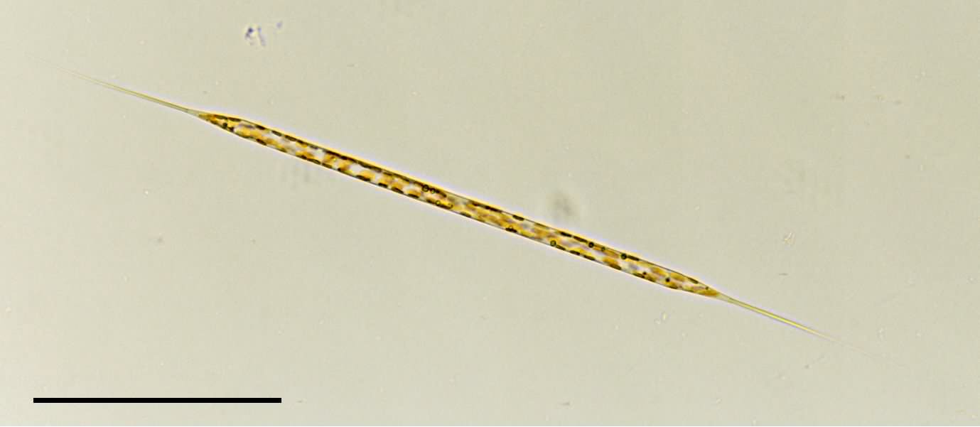 リゾソレニア （Rhizosolenia sp.）の画像