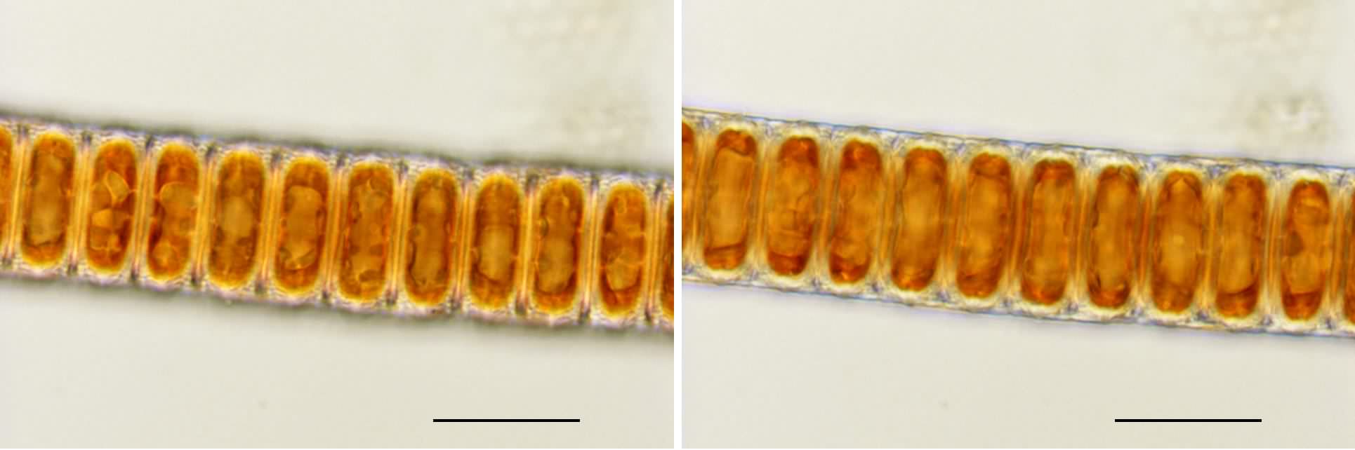 パラリア (Paralia sp.)の画像