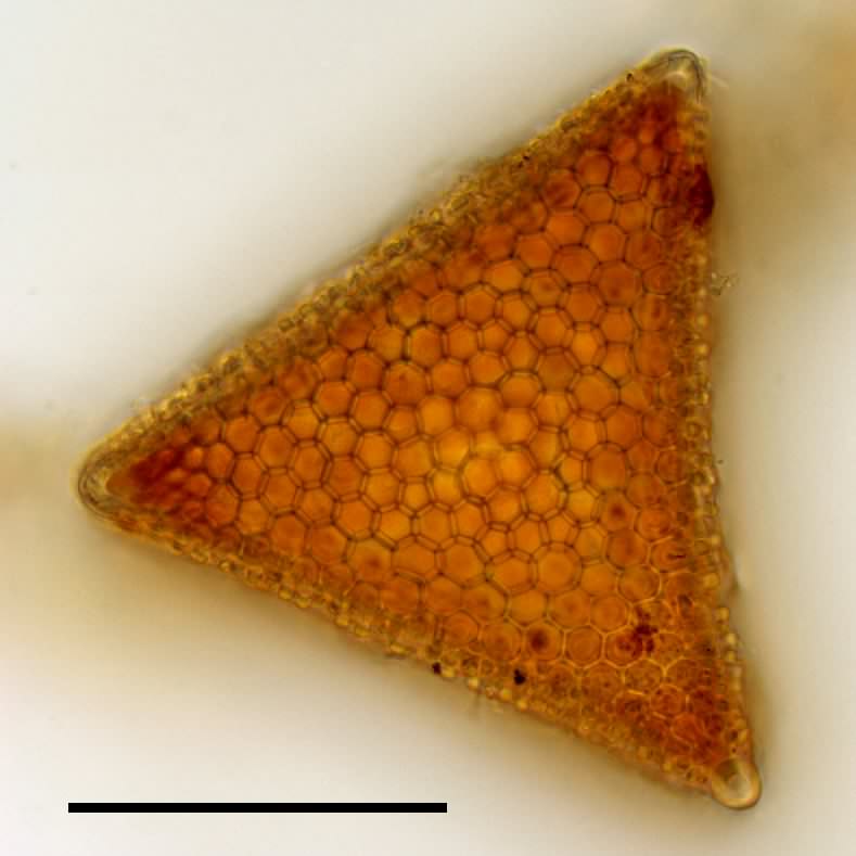 トリセラチウム (Triceratium sp.)の画像