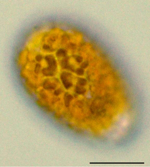 ラフィド藻類の不明種（海生）の画像