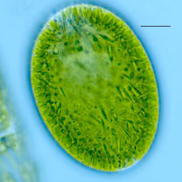 ラフィド藻類の不明種（淡水生）の画像