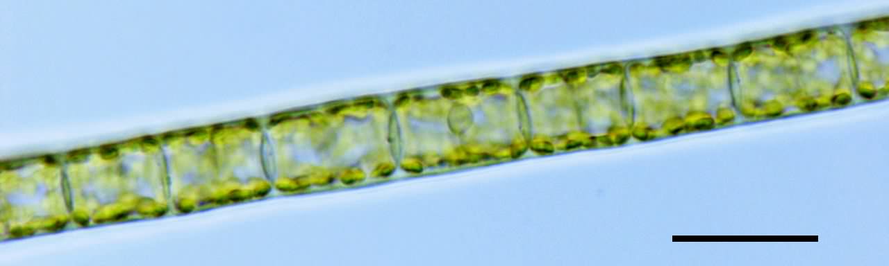 トリボネマ （Tribonema sp.）の画像