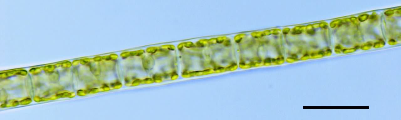 トリボネマ （Tribonema sp.）の画像