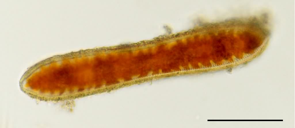 ハダナミケイソウ （Cymatopleura sp.）の画像