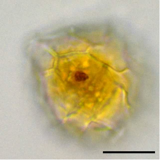 ウズオビムシ （Peridinium sp.）の画像