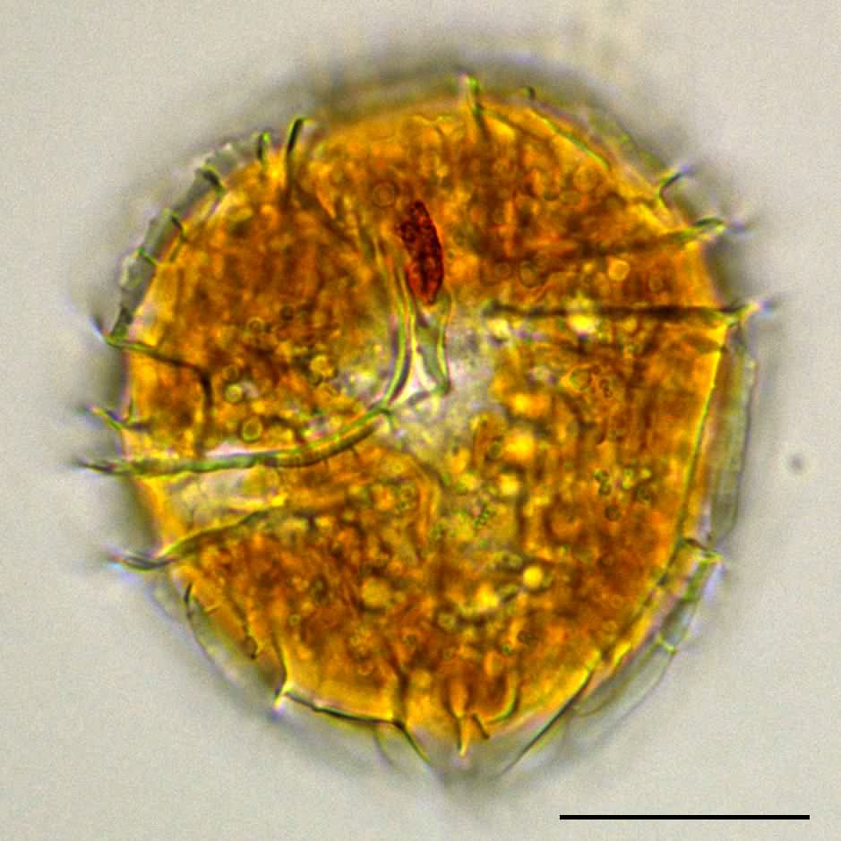 ウズオビムシ （Peridinium sp.）の画像