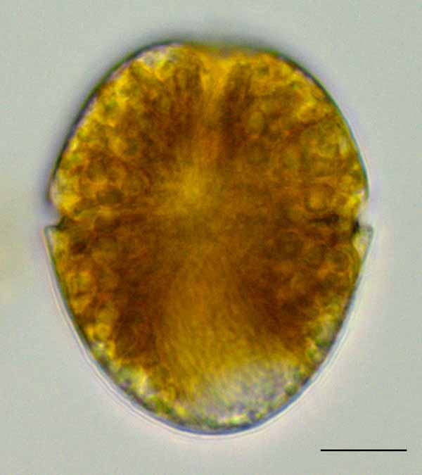 ハダカオビムシ （Gymnodinium sp.） の画像