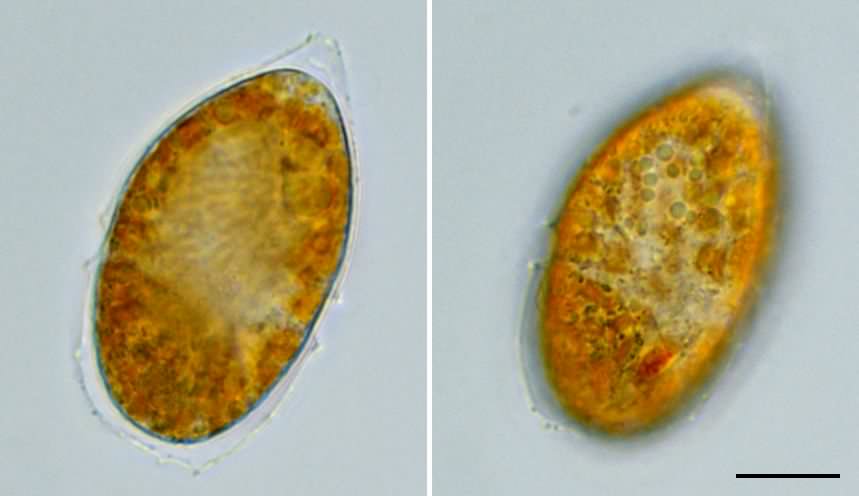 渦鞭毛藻類の不明種の画像