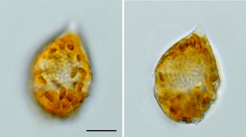 マルスズオビムシ（Scrippsiella trochoidea）の画像