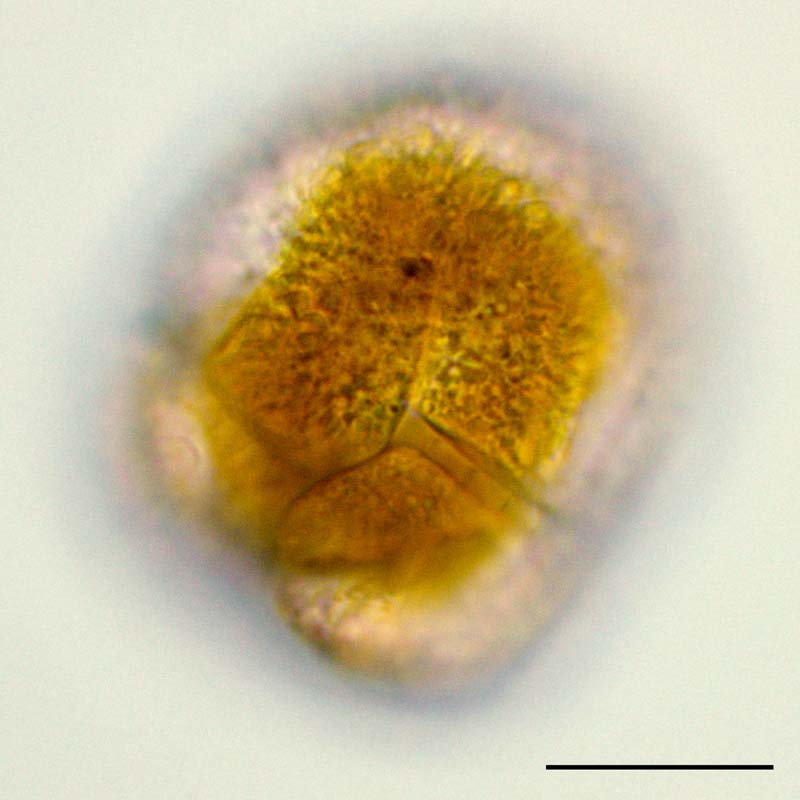 ハダカオビムシ （Gymnodinium sp.） の画像