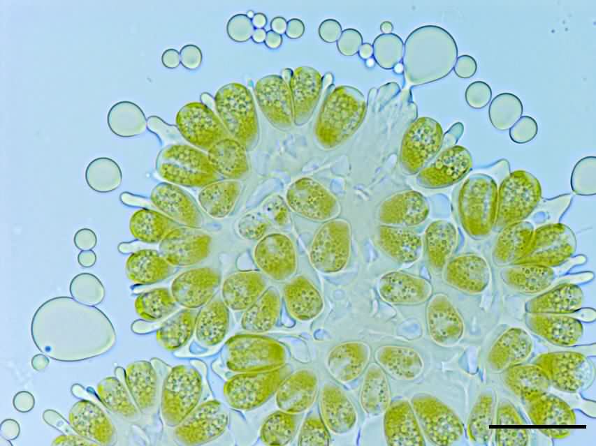 ボツリオコッカス（Botryococcus sp）の画像