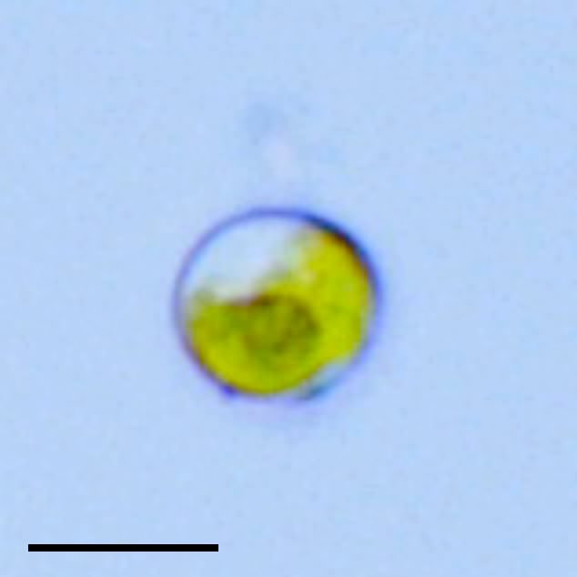 レボウクシア藻類の画像