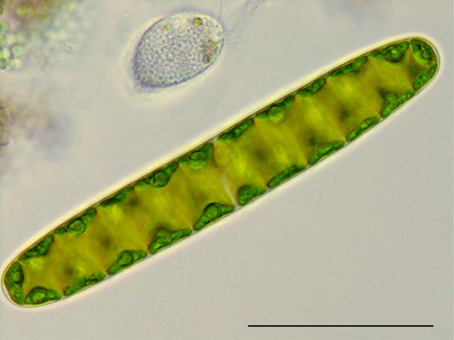 スピロテニア （Spirotaenia condensata）の画像