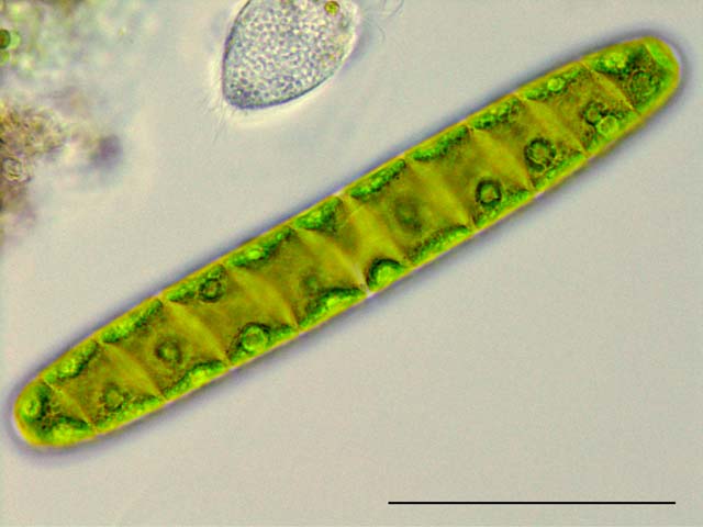 スピロテニア （Spirotaenia condensata）の画像