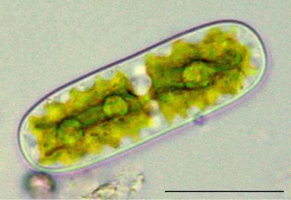フタホシモ （Cylindrocystis sp.）の画像