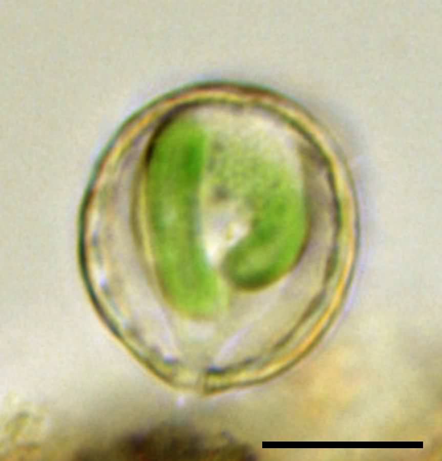 パウリネラ クロマトフォラ(Paulinella chromatophora)の画像