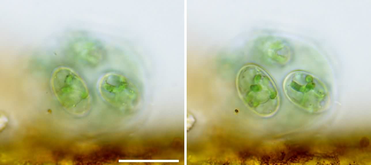 グラウコキスチス （Glaucocystis sp.） の画像