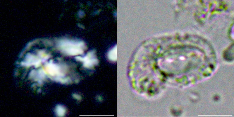ココリス(Helicosphaera sp1.)の画像