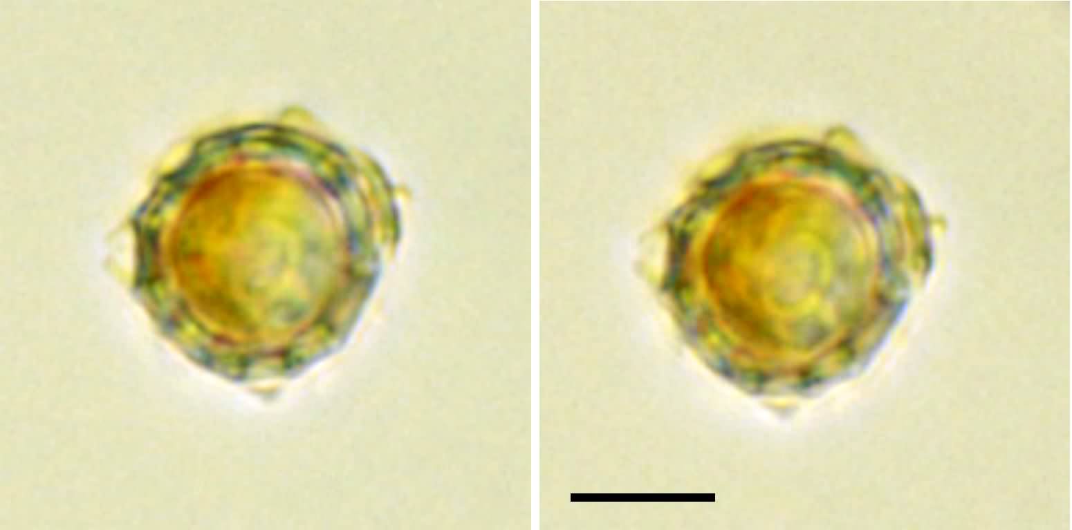 円石藻類 ゲフィロカプサ （Gephyrocapsa sp.） の画像