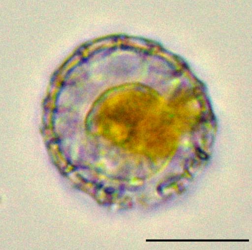 円石藻類 コロノスファエラ （Coronosphaera sp.） の画像
