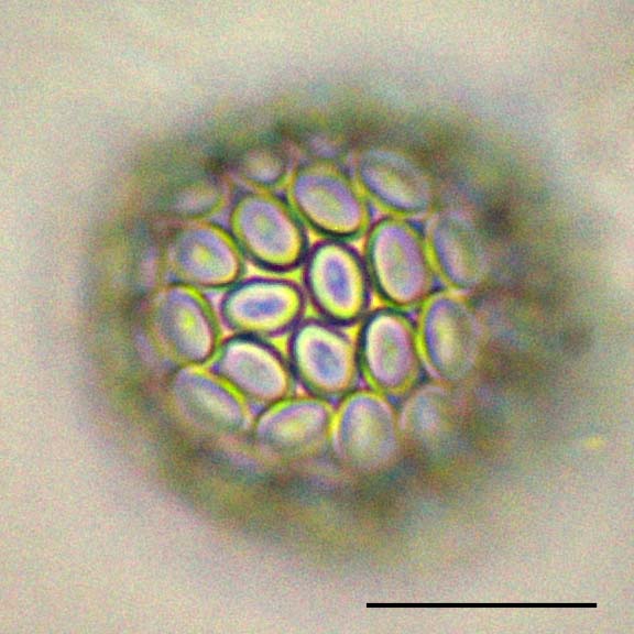 円石藻類 コロノスファエラ （Coronosphaera sp.） の画像