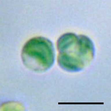 イデユコゴメ（Cyanidium sp.）の画像