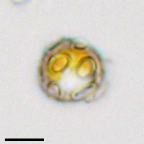 ゲフィロカプサ(Gephyrocapsa sp.） の画像