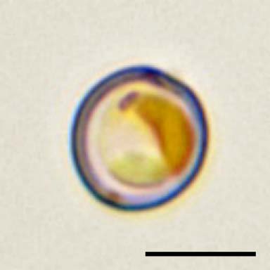 クリソコックス(Chrysococcus sp.)の画像
