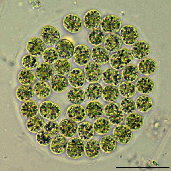 ミクロキスチス （Microcystis sp.）の画像