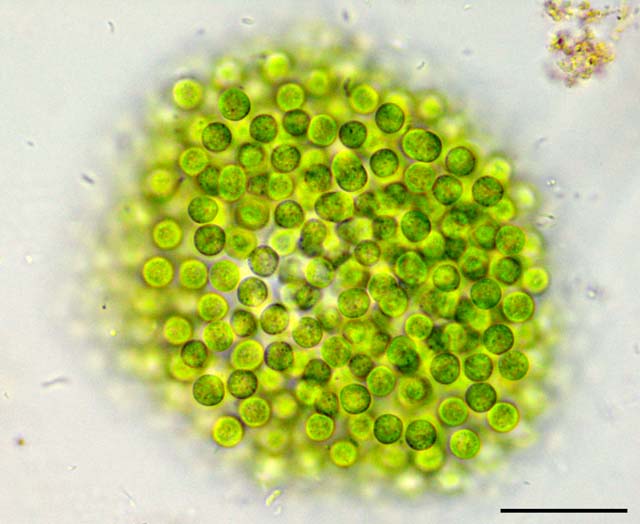 ミクロキスチス （Microcystis sp.）の画像