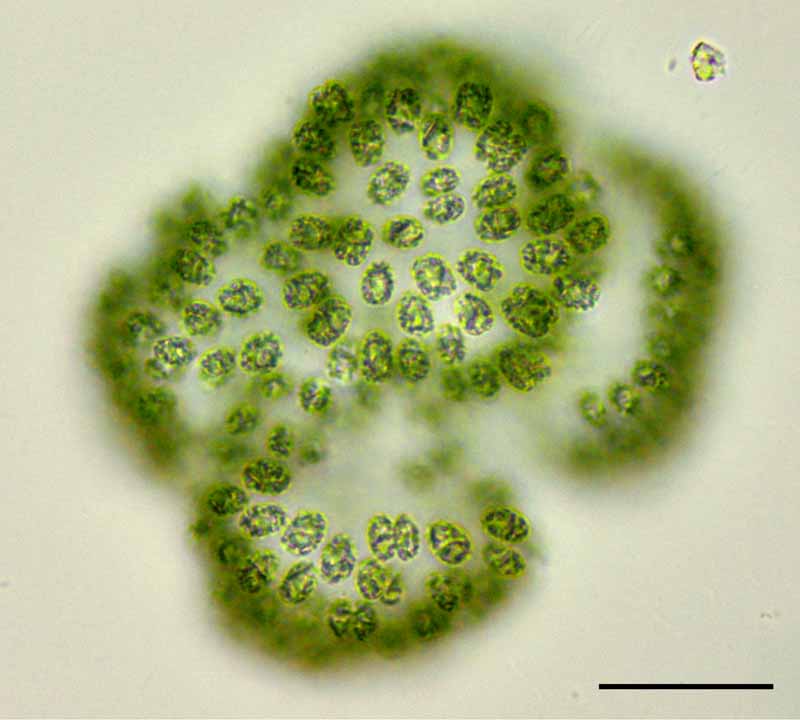 アオコモドキ （Woronichinia 属）の画像