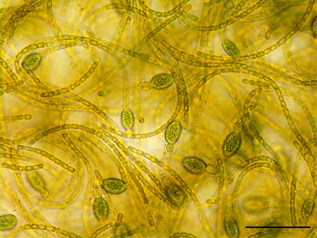 キリンドロスペルムム(Cylindrospermum)の画像