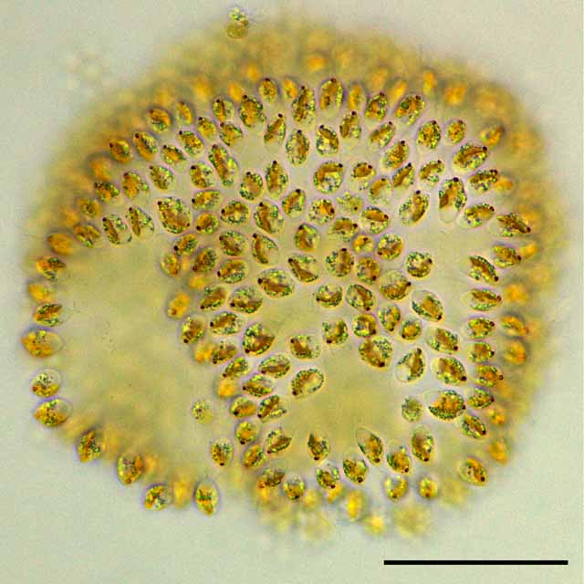 ニセクスダマヒゲムシ（Uroglenopsis)の画像