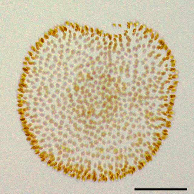 ニセクスダマヒゲムシ（Uroglenopsis)の画像