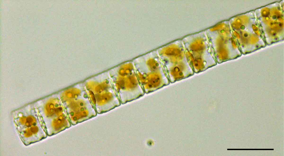 ディアトマ（Diatoma mesodon）の画像