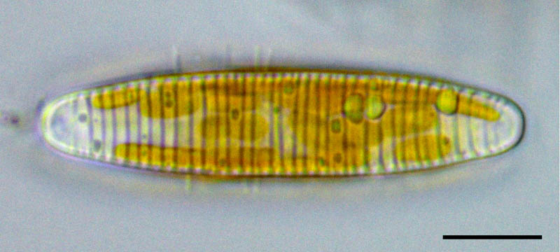 ディアトマ（Diatoma sp.）の画像
