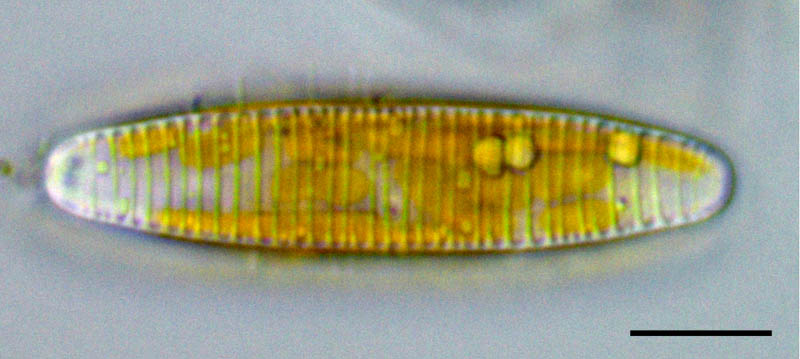 ディアトマ（Diatoma sp.）の画像